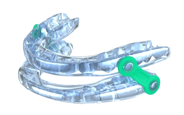 Custom mandibular advancement device for sleep apnea treatment at Esthetique Dentistry Ashburn